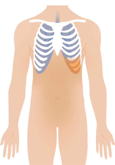 tudovizenyo, ascites kezeles Ewicarenel